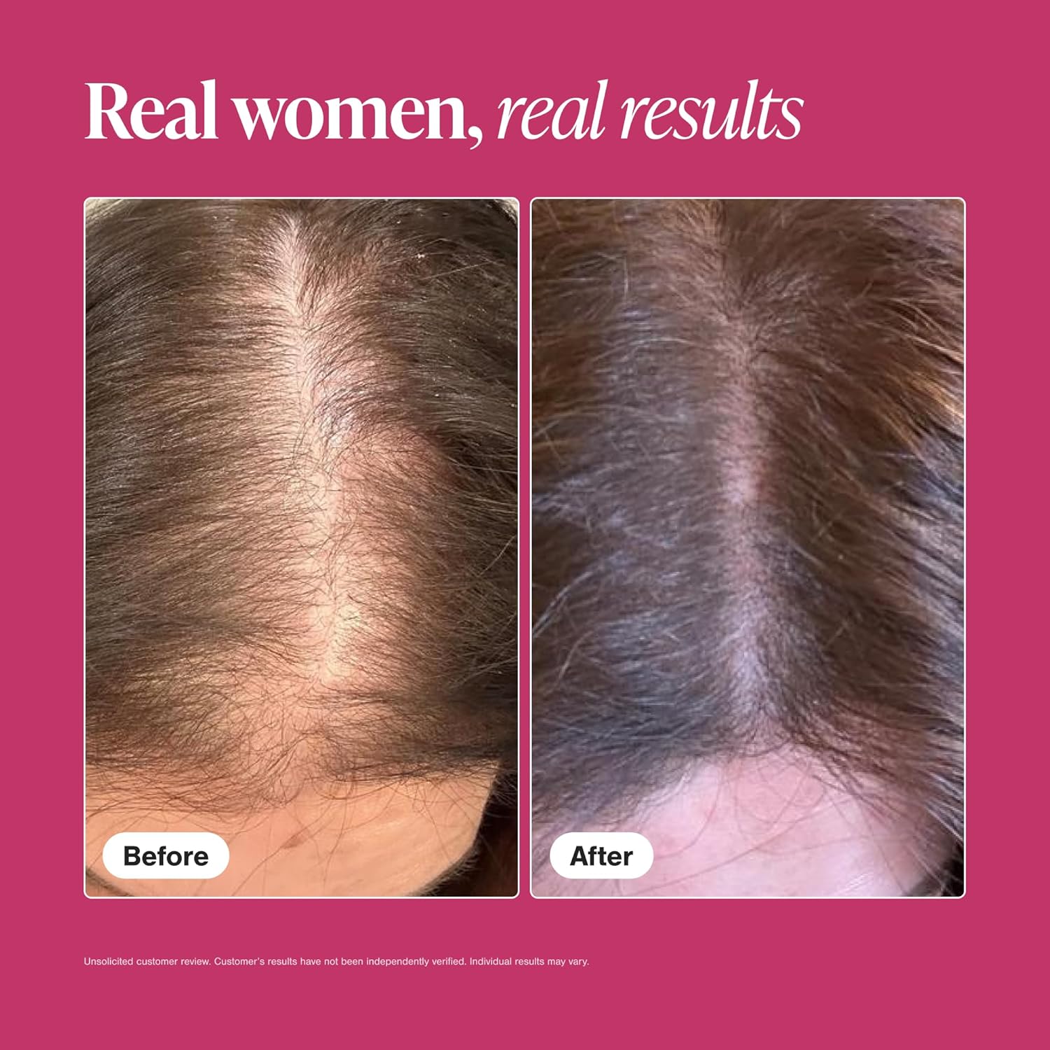 Viviscal, Hair Growth Supplements, 180 Tablets, 3 Month Supply.