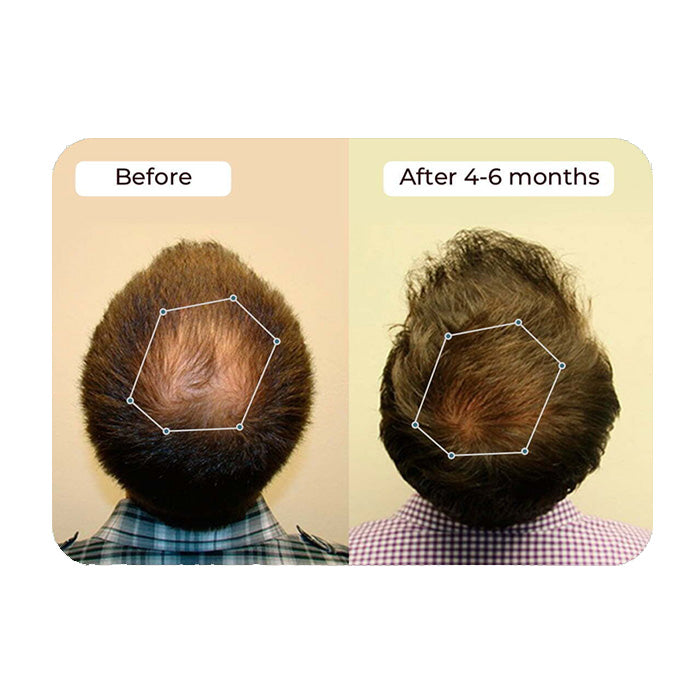 Vital Hair Complex - 3 Pack