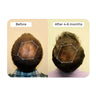 Vital Hair Complex